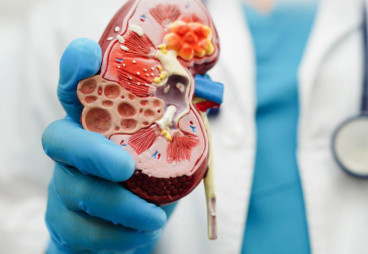 Third party nephrology medicine manufacturing